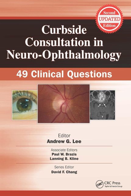 Curbside Consultation in Neuro-Ophthalmology: 49 Clinical Questions (Curbside Consultation in Ophthalmology)