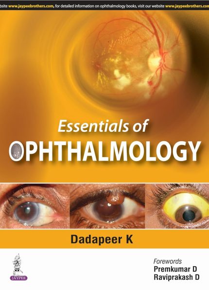 Essentials of Ophthalmology