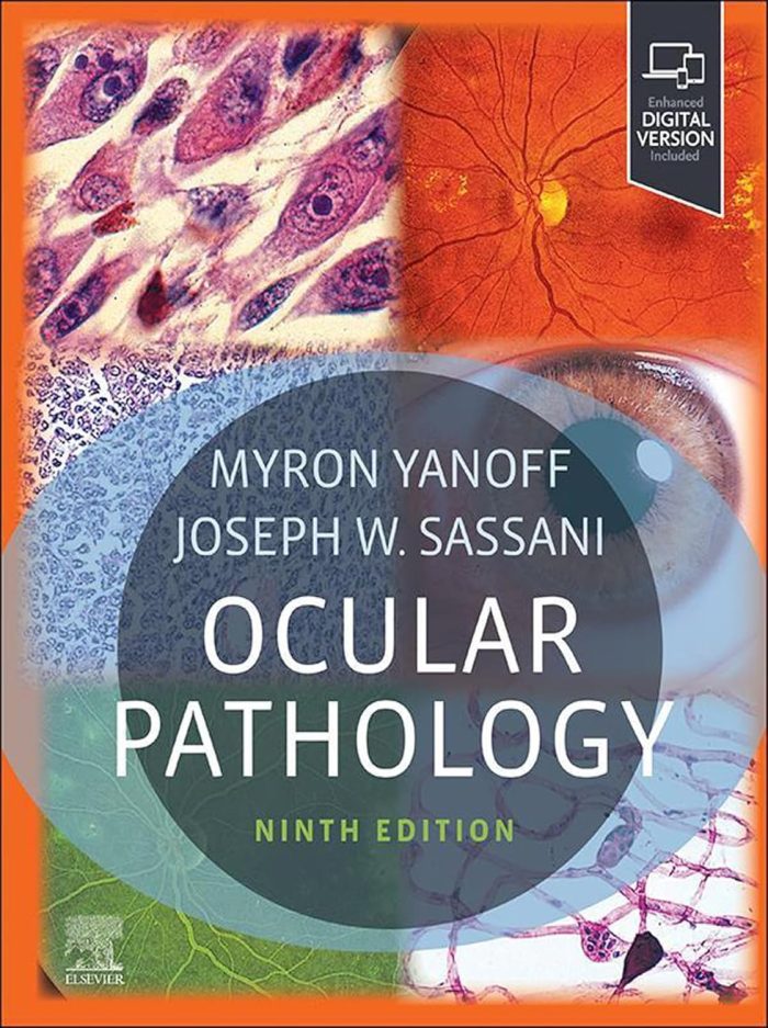 Ocular Pathology - E-Book