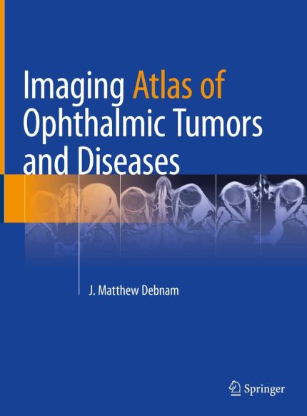 Imaging Atlas of Ophthalmic Tumors and Diseases (English Edition)