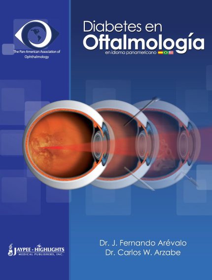 Diabetes en Oftalmologia (Spanish Edition)
